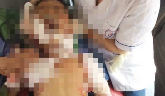 Một bé trai 7 tuổi ở Thái Nguyên bị chó nhà cắn tử vong