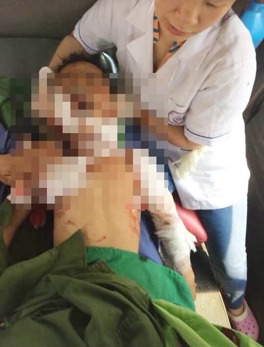 B&eacute; trai bị ch&oacute; nh&agrave; nu&ocirc;i&nbsp;cắn tử vong.