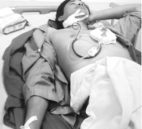 Nạn nh&acirc;n Duy tại Bệnh viện.