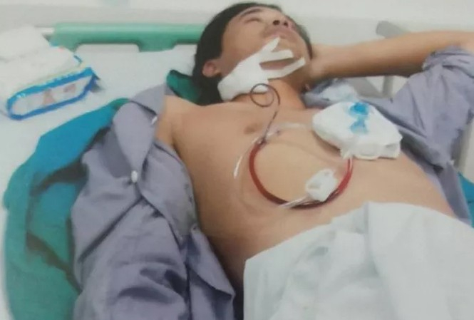 Anh Mai Thế Duy (con bà Lý) bị vỡ xương hàm mặt cầu lồi bên phải, tỉ lệ thương tật 15%.