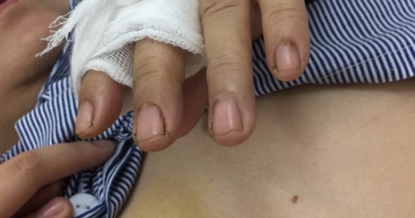 Cháu ruột hành hung bác gái gây thương tích, vì sao Công an quận Đống Đa chưa giải quyết dứt điểm?