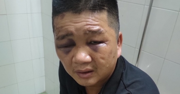 Vây bắt đối tượng móc cốp xe trộm 100 triệu đồng