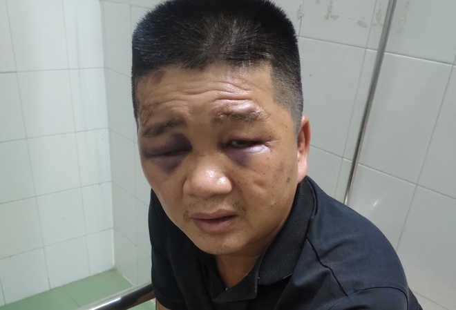 tin-tuc-phap-luat-ngay-542021-di-chan-bo-phat-hien-thi-the-dang-phan-huy-tren-doi-2