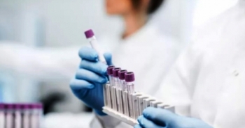 Danh sách 114 đơn vị được cấp phép thực hiện xét nghiệm khẳng định COVID-19