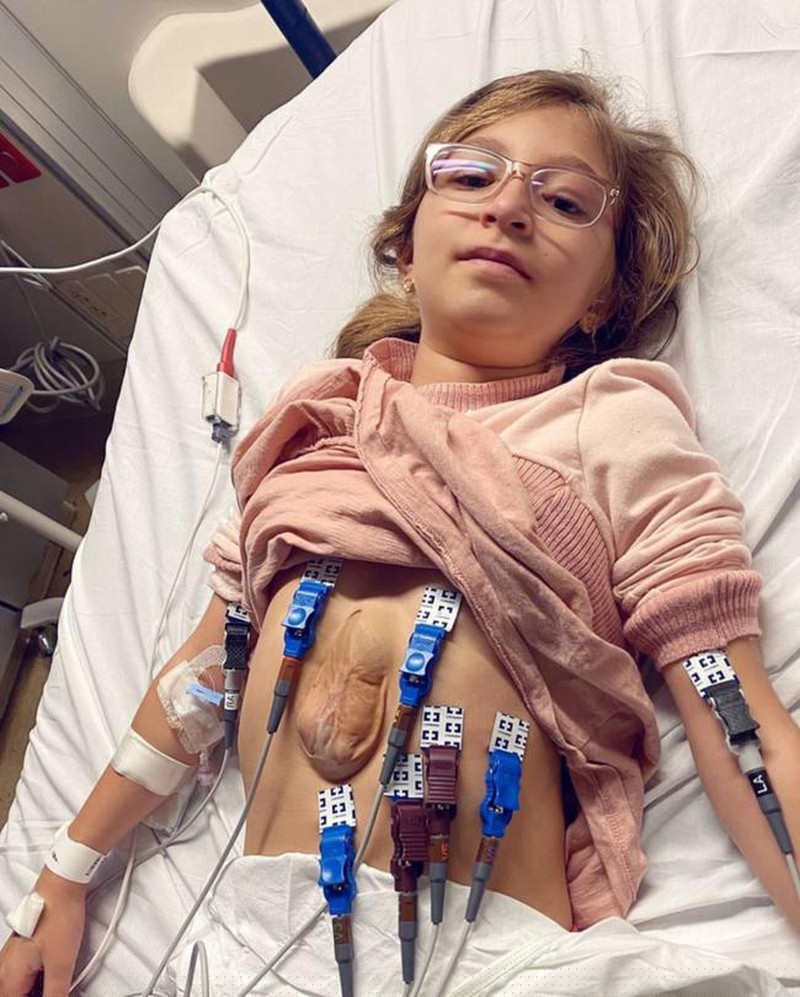 Cô bé Virsaviya Borun mắc hội chứng hiếm gặp mang tên Pentalogy of Cantrell tức là