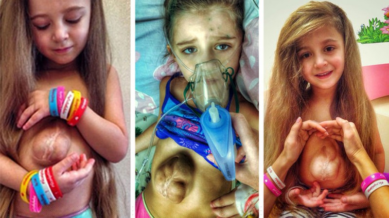 Phải trải qua nhiều ca phẫu thuật rất đau đớn nhưng Virsaviya Borun luôn lạc quan, yêu đời. 