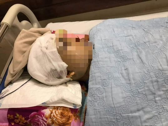 Hải Dương: Phó Chủ tịch UBND xã bị đánh chấn thương sọ não khi thực hiện nhiệm vụ