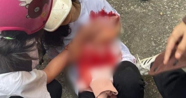 Nữ sinh lớp 10 dùng "dao gấp" đâm 2 bạn khác phải nhập viện