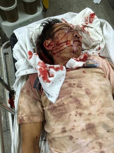 &Ocirc;ng Q&uacute;y bị đ&aacute;nh trọng thương.