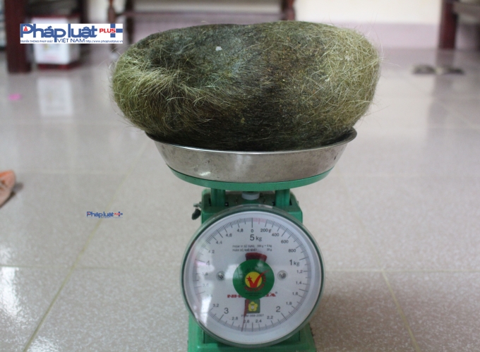Vật thể lạ c&oacute; c&acirc;n nặng gần 2,8 kg (ảnh Văn Lịnh).