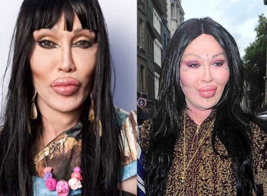 Amanda Lepore l&agrave; một người mẫu ki&ecirc;m ca sĩ chuyển giới c&oacute; tiếng trong l&agrave;ng giải tr&iacute; Mỹ. Bệnh nghiện phẫu thuật dường như đ&atilde; ph&aacute; n&aacute;t th&acirc;n h&igrave;nh, khu&ocirc;n mặt khiến Amanda lu&ocirc;n xuất hiện trong danh s&aacute;ch