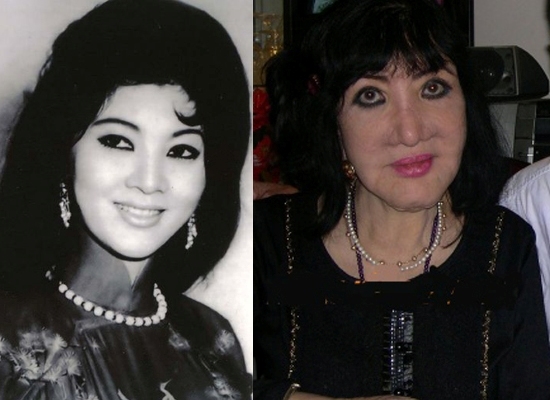 Thẩm Th&uacute;y Hằng - mỹ nh&acirc;n của l&agrave;ng giải tr&iacute; Việt một thời cũng l&agrave; nạn nh&acirc;n của phẫu thuật thẩm mỹ