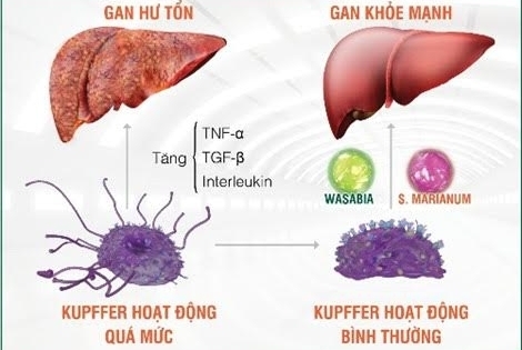 Gan gặp bệnh khi tế bào Kupffer hoạt động quá mức