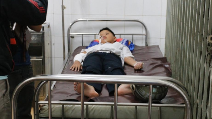 5 trường hợp th&igrave; c&oacute; một em bị bỏng nặng tr&ecirc;n 11%.