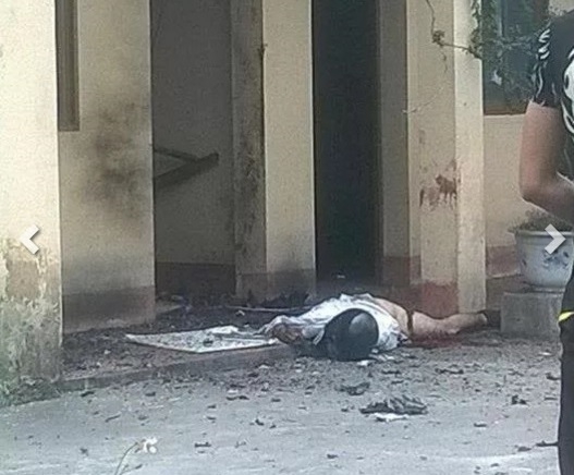 Nạn nh&acirc;n sau khi tự s&aacute;t bằng m&igrave;n.