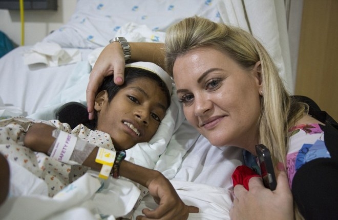 Bệnh lạ khiến đầu cậu b&eacute; xoay 180 độ