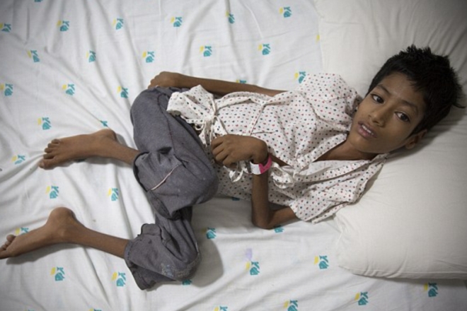 Bệnh lạ khiến đầu cậu b&eacute; xoay 180 độ