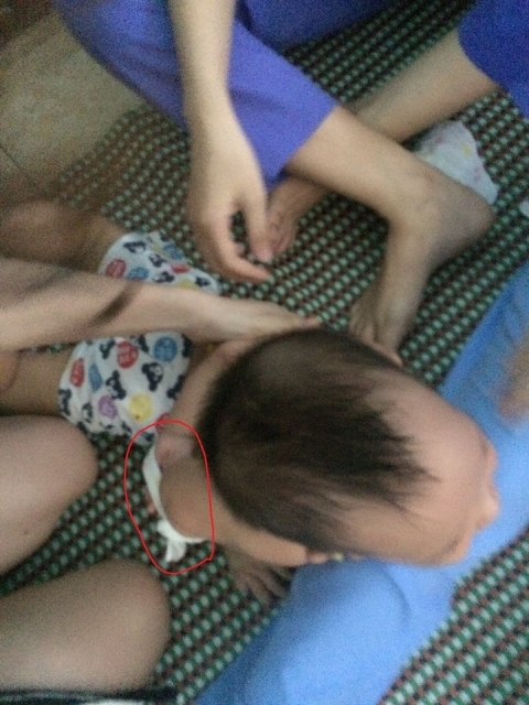 Trẻ bị bạo h&agrave;nh v&igrave; kh&ocirc;ng chịu ăn.