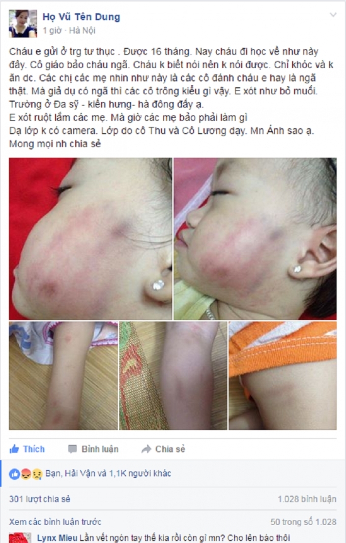 H&igrave;nh ảnh ch&aacute;u P. được đăng l&ecirc;n mạng x&atilde; hội chiều 26/5. (Ảnh: FB).