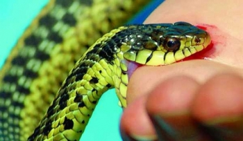 Bác sĩ lưu ý cách xử trí khi bị rắn cắn