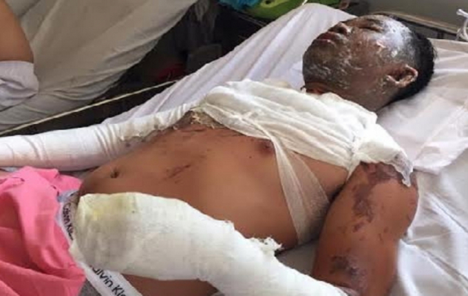 &nbsp;&Ocirc;ng T&acirc;m tại Bệnh viện Chợ Rẫy. (Ảnh: b&aacute;o VTC New)