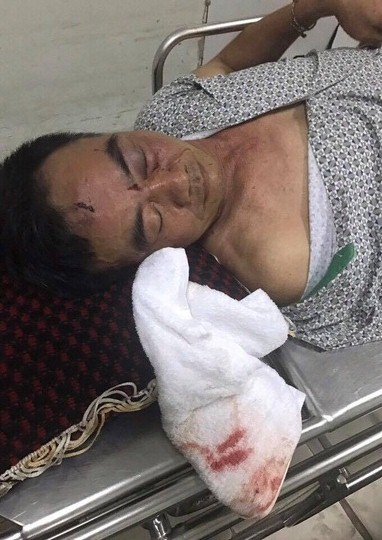 &Ocirc;ng Ho&agrave;ng Văn Thảo điều trị tại bệnh viện.(Ảnh gia đ&igrave;nh cung cấp).