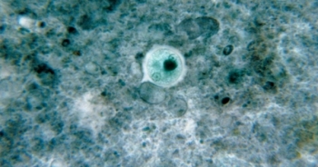 Chế tạo thành công vắcxin phòng bệnh amip sau 20 năm nghiên cứu