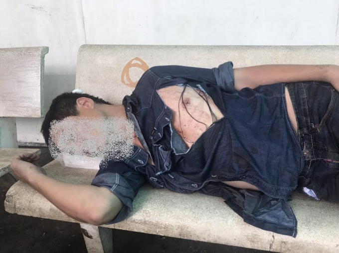 Việc anh T. bị h&agrave;nh hung trọng thương, rất mong cơ quan c&ocirc;ng an v&agrave;o cuộc điều tra, trừng trị c&aacute;c đối tượng.