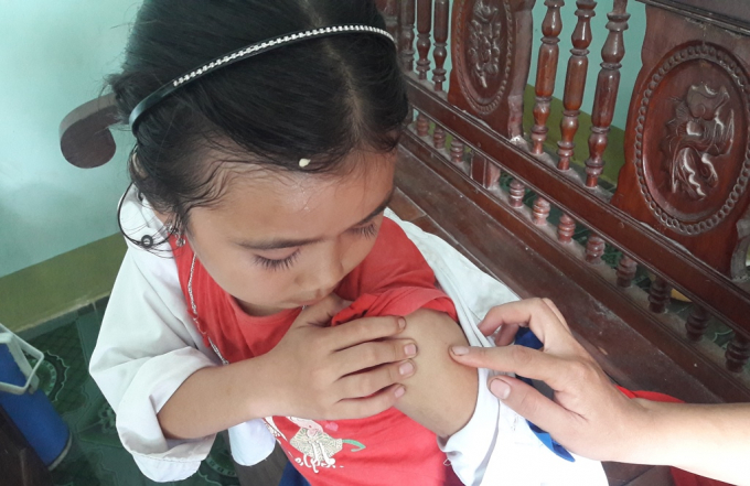 Th&ugrave;y Trang chỉ vị tr&iacute; m&igrave;nh bị người đ&agrave;n &ocirc;ng bịt mặt ti&ecirc;m thuốc. Hiện tại b&eacute; g&aacute;i vẫn rất lo lắng, gia đ&igrave;nh mong muốn cơ quan chức năng sớm l&agrave;m r&otilde; sự việc.