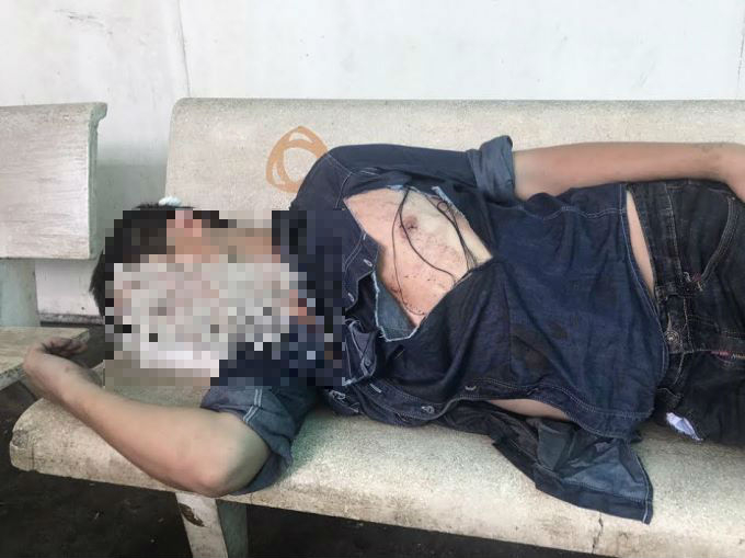 Anh T. bị đ&aacute;nh r&aacute;ch quần &aacute;o tả tơi.