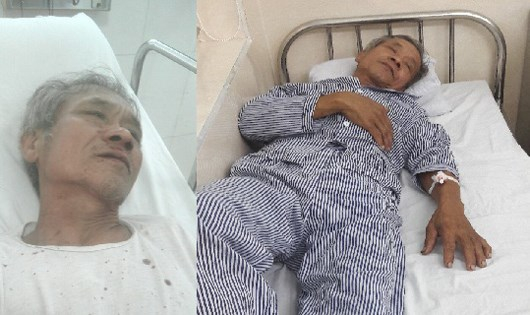 &Ocirc;ng Bảo điều trị tại Bệnh viện Hữu nghị Việt Tiệp v&agrave; được chẩn đo&aacute;n &ldquo;g&atilde;y xương sườn&rdquo;.