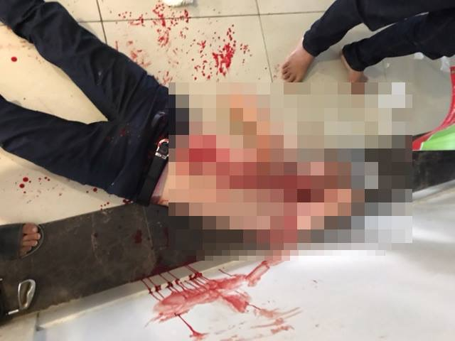 Anh T bị ch&eacute;m trọng thương khi đang đứng đợi bạn.