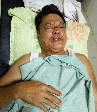 &Ocirc;ng H&ograve;a được đưa đến bệnh viện điều trị sau khi bị bố con vị gi&aacute;m đốc đ&aacute;nh.