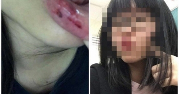 Vụ MC bị tố bạo hành: 