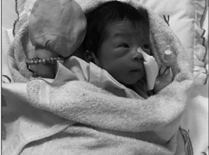 B&eacute; trai đang được chăm s&oacute;c tại bệnh viện.