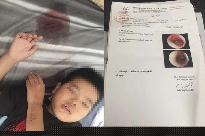 Cô giáo đánh loạt học sinh tại Hải Phòng: Công an đề xuất hình thức xử lý