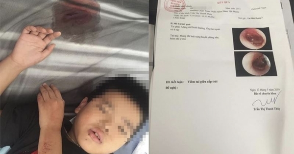 Cô giáo đánh loạt học sinh tại Hải Phòng: Công an đề xuất hình thức xử lý