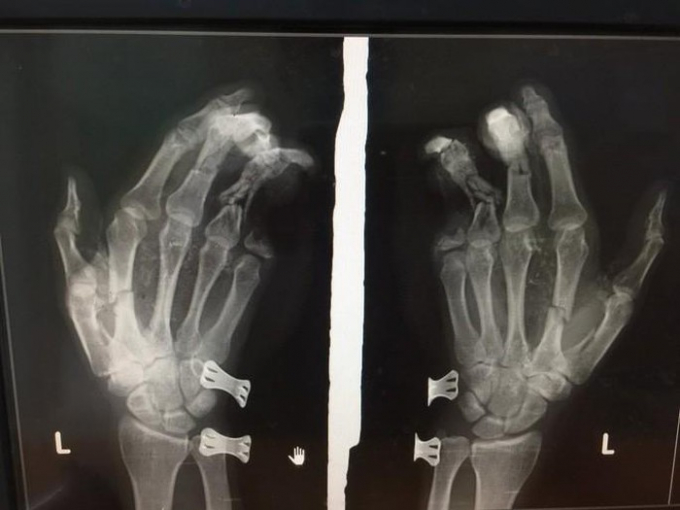 7c6cb608e04b0915505a