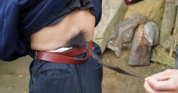 Video phóng sự: Chuyện đời của “người đàn ông mọc đuôi" ở Hà Giang