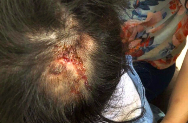 Hà Tĩnh: Khởi tố vụ án dì ruột hành hạ cháu gái 4 tuổi để điều tra