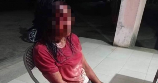 Quảng Bình: Mâu thuẫn gia đình, chồng chém vợ trọng thương rồi bỏ "cuốn gói" rời đi