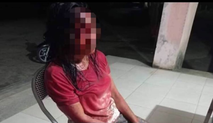 Chị Hiền phải đi cấp cứu tại Trạm y tế Hương Hóa, sau đó chuyển lên tuyến trên để tiếp tục điều trị.