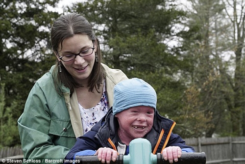 Cậu b&eacute; bị bệnh lạ c&ugrave;ng mẹ chơi đ&ugrave;a.