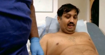 Phẫu thuật cho người đàn ông có “cậu bé khủng” nhỏ đi