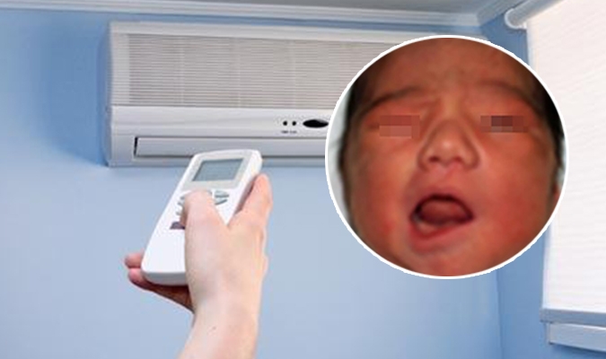 Trẻ sẽ bị m&eacute;o mặt nếu nằm điều h&ograve;a qu&aacute; nhiều. (Ảnh minh họa)