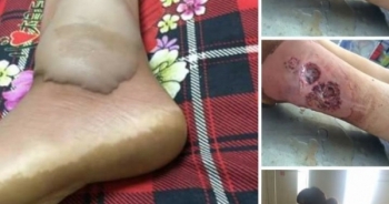 Vụ người nhà tố bác sĩ BVĐK Đoan Hùng làm ngơ bệnh nhân: Người nhà nói có, bệnh viện nói không?