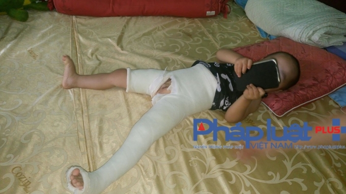 Ch&aacute;u Nguyễn Ho&agrave;ng Nam vừa điều trị b&oacute; bột về.