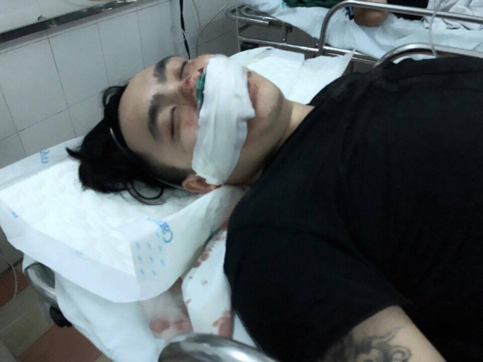 Hiện nạn nh&acirc;n đang điều trị tại bệnh viện.