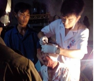 Nam thanh niên dùng đá ném sứt đầu cụ ông hàng xóm chỉ vì… ngứa mắt