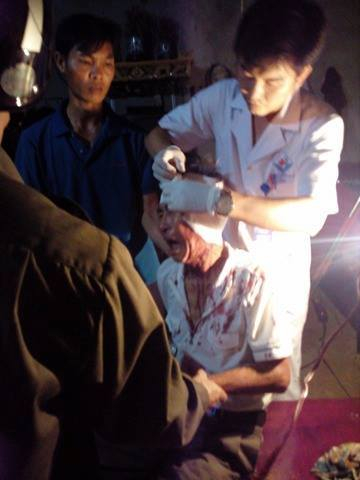 &Ocirc;ng Qu&acirc;n bị đối tượng d&ugrave;ng đ&aacute; n&eacute;m g&acirc;y chấn thương, chảy m&aacute;u đầu.